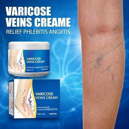 Varicose Veins Relief Cream