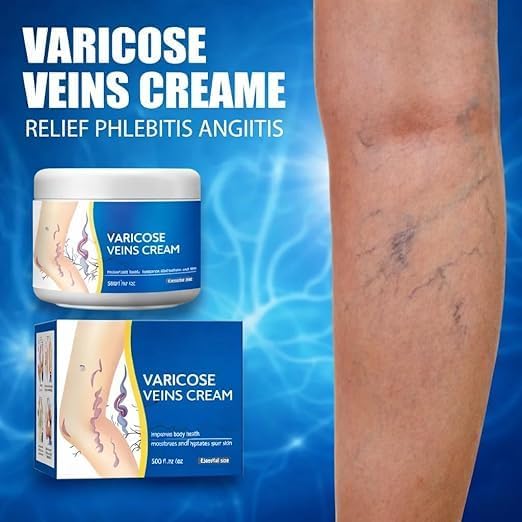 Varicose Veins Relief Cream