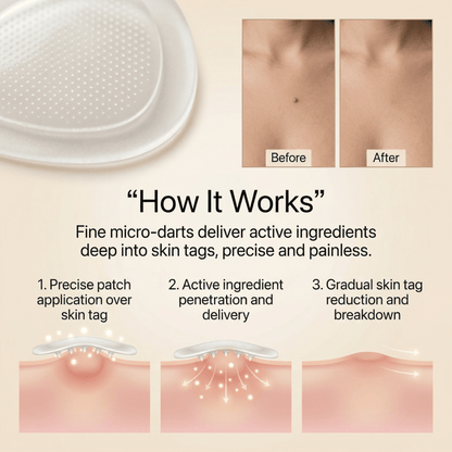 DermaSmooth - Tag & Mole Remover