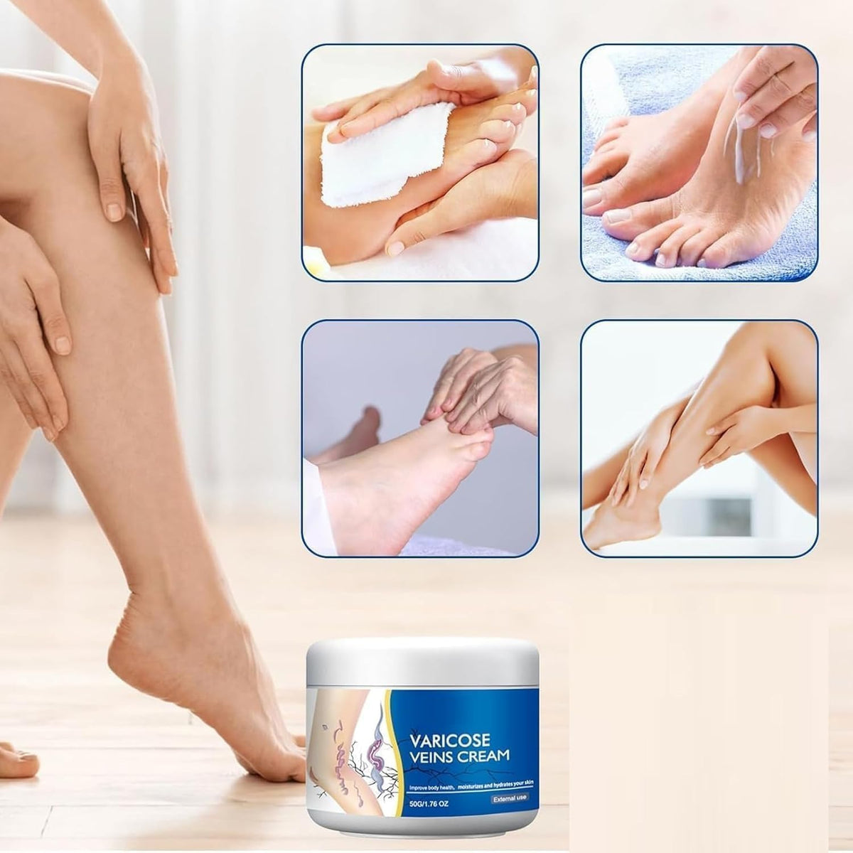 Varicose Veins Relief Cream