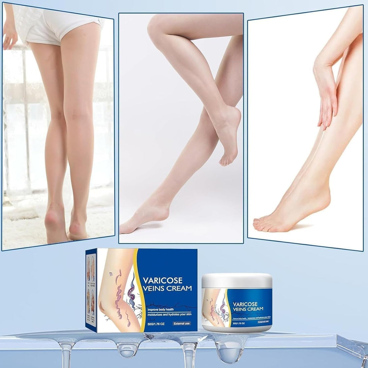 Varicose Veins Relief Cream