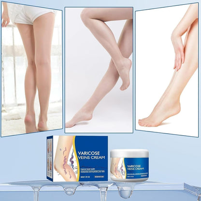 Varicose Veins Relief Cream