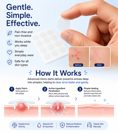 PimpleOut™ – Invisible Acne Patch