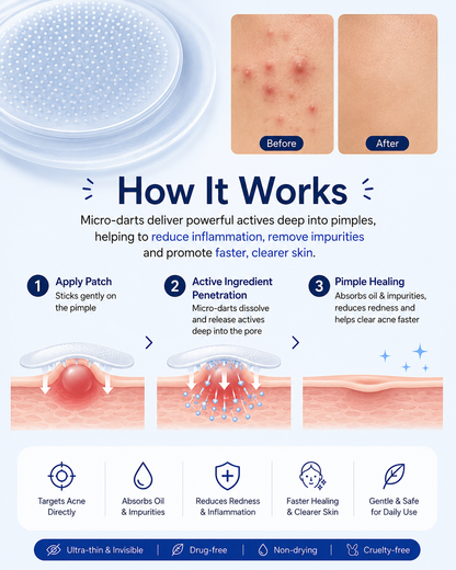 PimpleOut™ – Invisible Acne Patch
