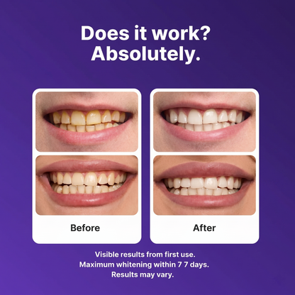 Pure Pearl™ - ProTeeth whitening strips