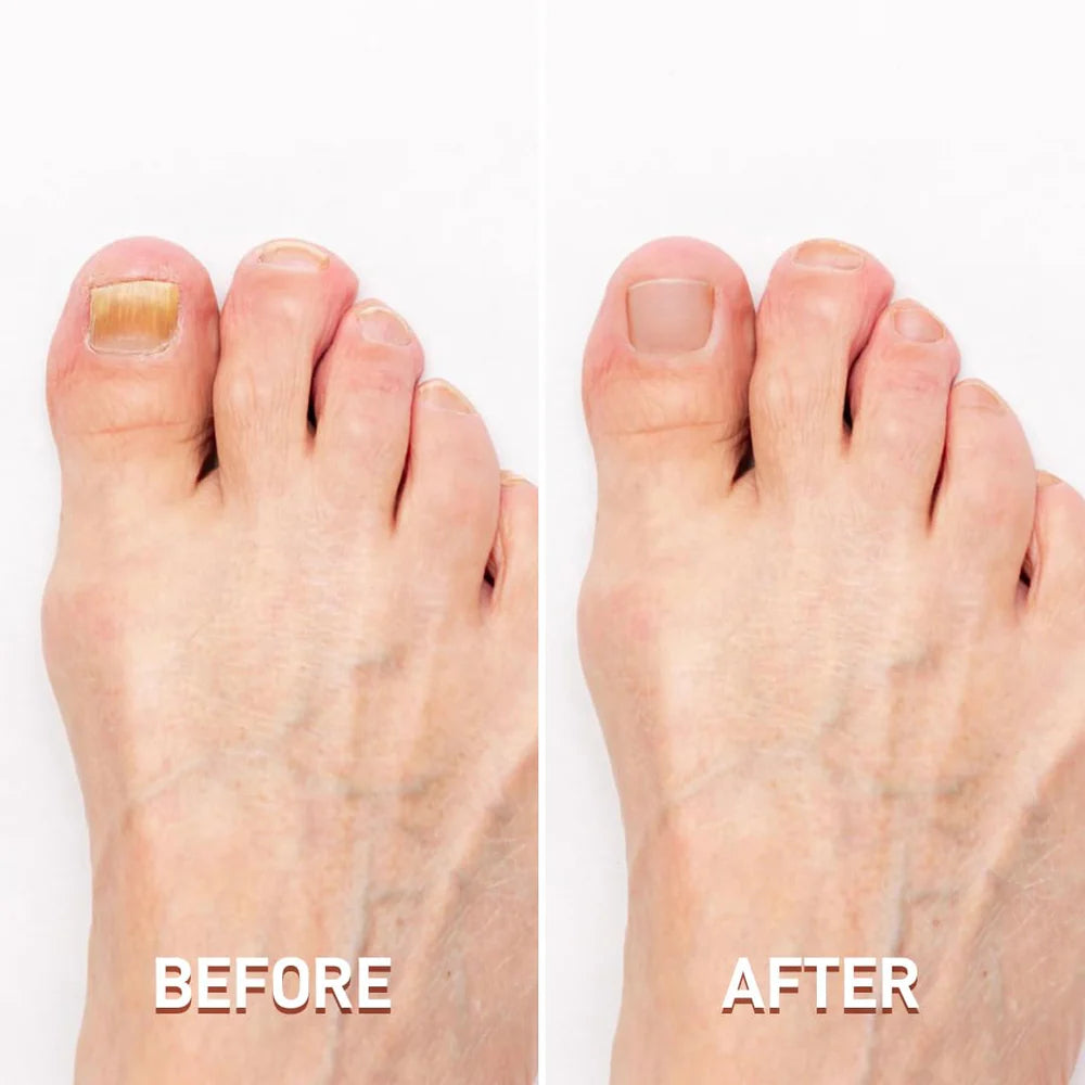 SharpLuxe™ – Ultimate Nail Care Clipper