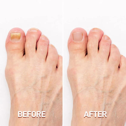 SharpLuxe™ – Ultimate Nail Care Clipper