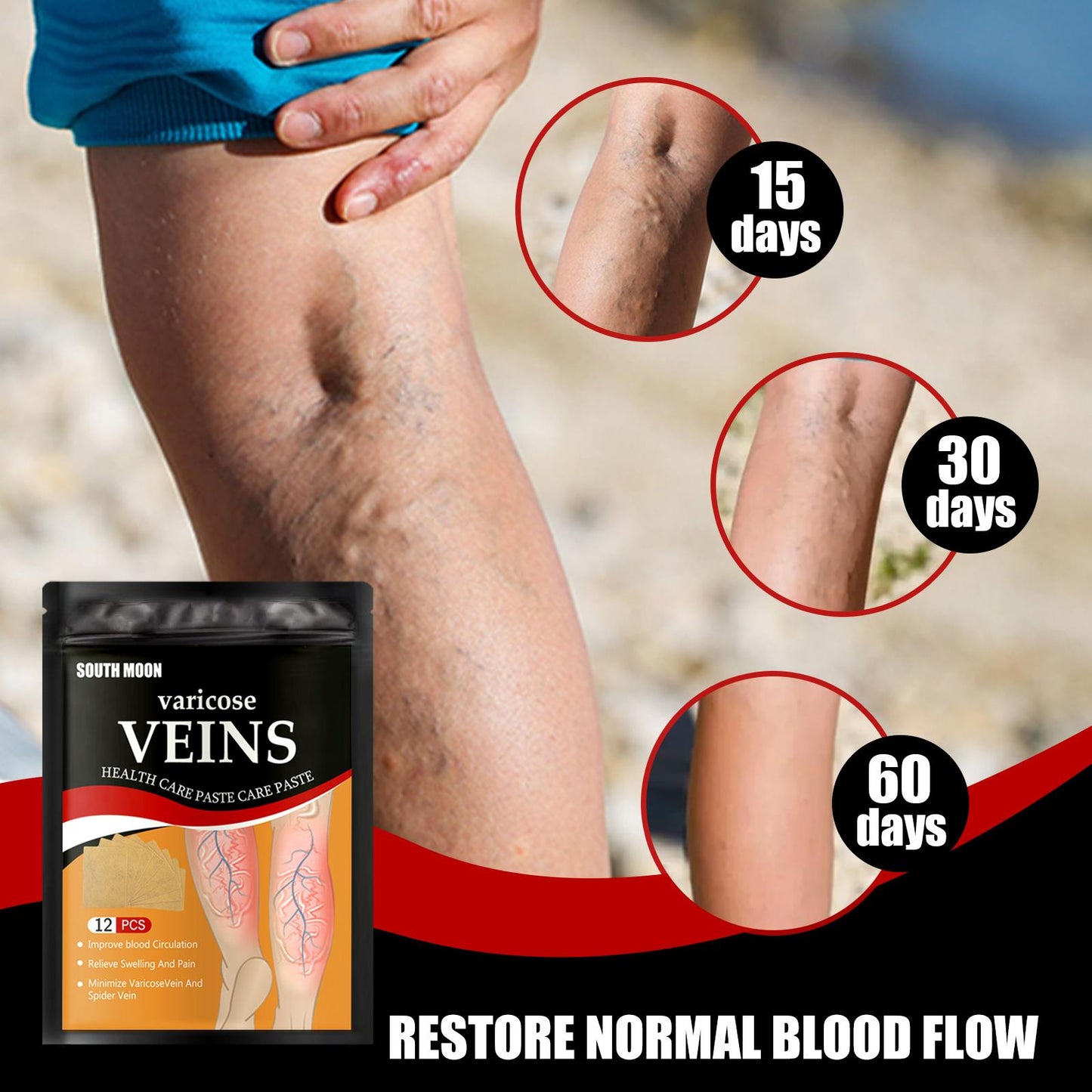 VeinEase™Natural Vein Patches