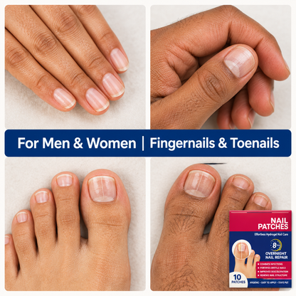 NailRevive patches for men and women, fingernails and toenails