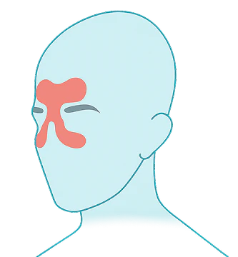 Sinus Pressure