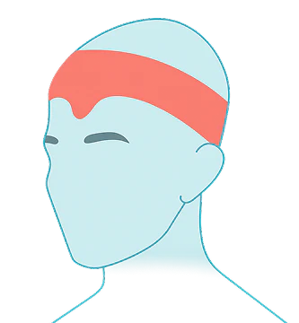 Tension Headaches