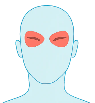Cluster Headaches